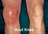 xgout-knee-image.jpg.pagespeed.ic.T3DPerZBEr.jpg