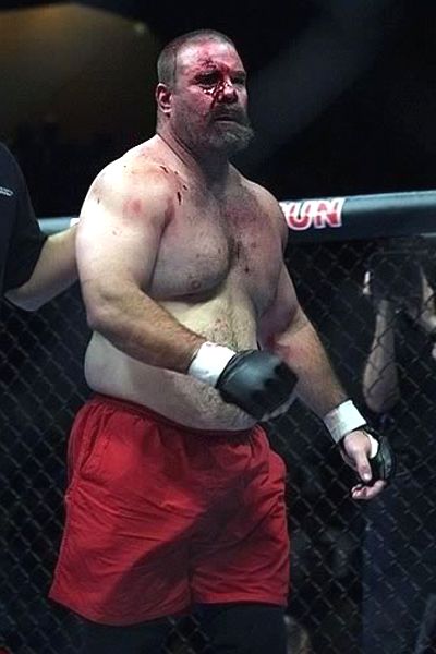 mma_tank_abbott_bloody_400.jpg