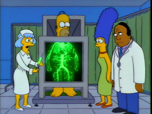 homerstriplebypass5.png