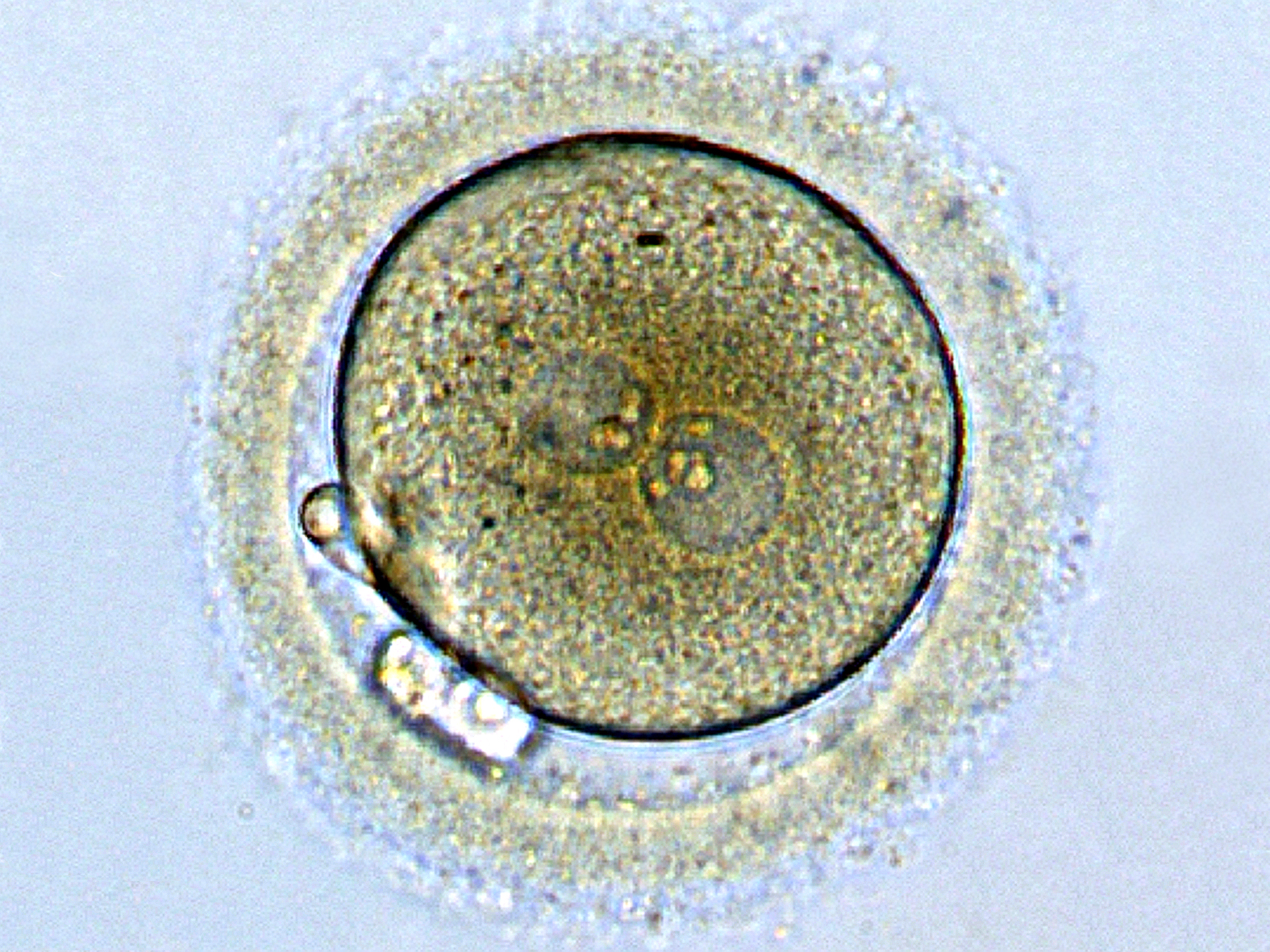 Zygote1.jpg