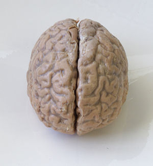 2008-05-14-HumanBrain.jpg