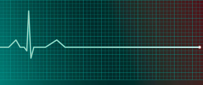flat-line-pic.jpg