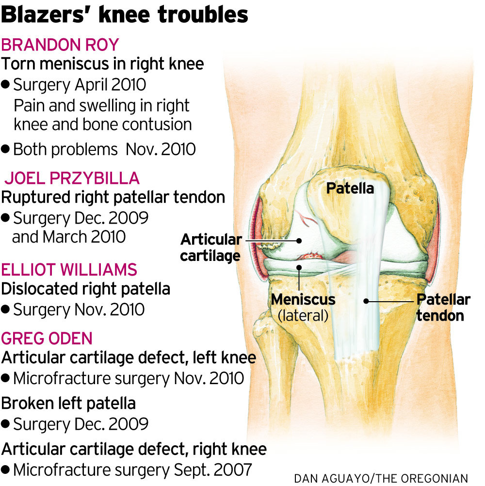 gs11knee121jpg-b8e276c6970d313b.jpg