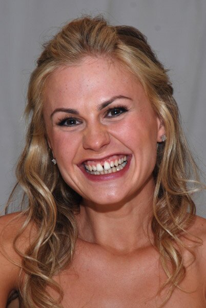 anna-paquin-big-teeth.jpg