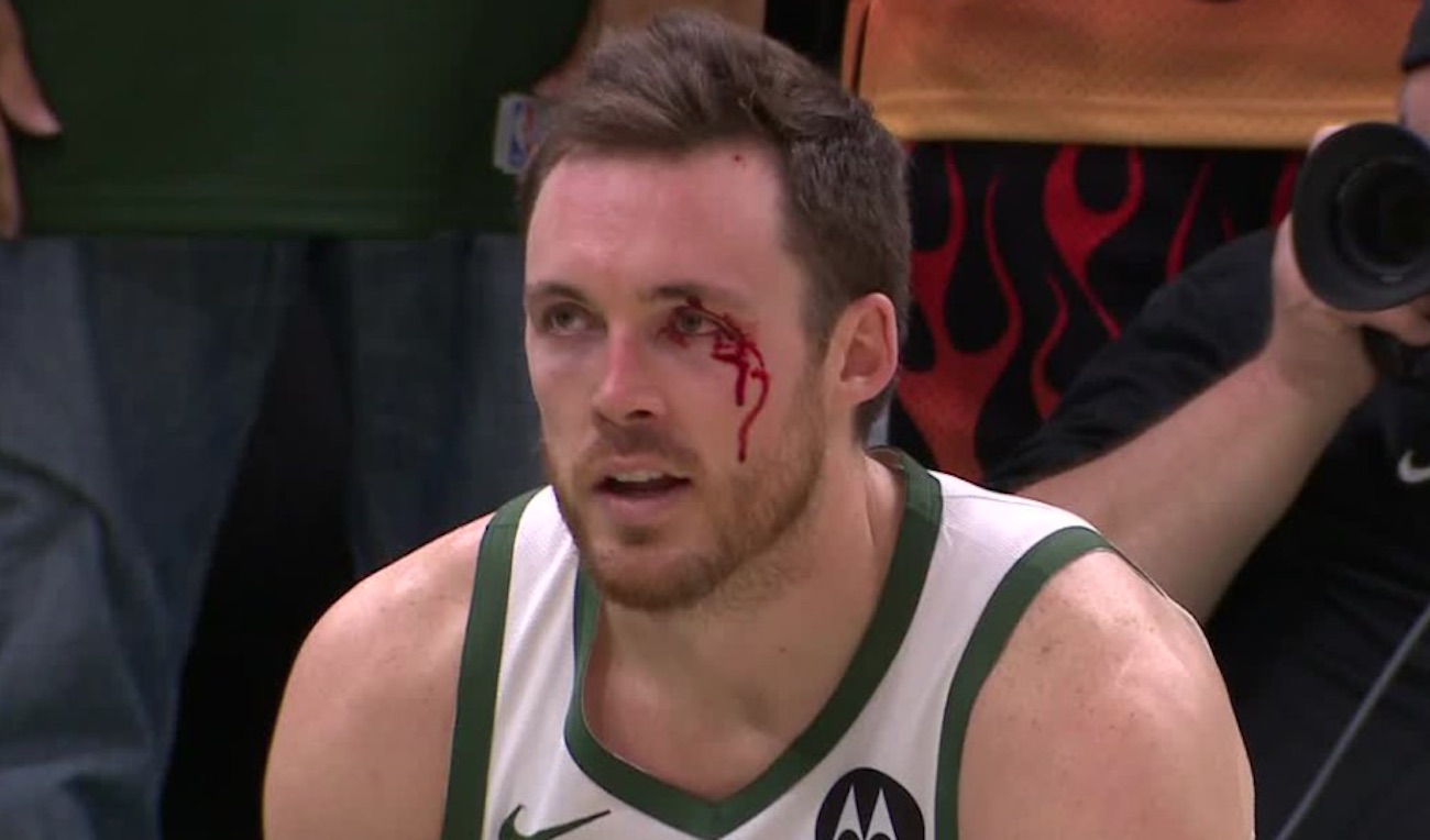 Pat-Connaughton-bloody.jpg