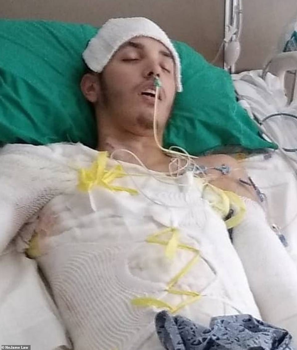 58115847-10841249-Lawyer_for_Barreto_says_he_sustained_third_degree_burns_on_appro-a-10_1653200077417.jpg